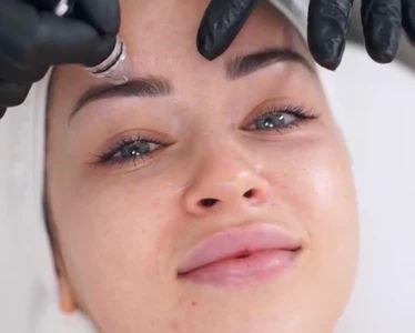 Discounted Facials and Skin Treatments at OVME! thumbnail